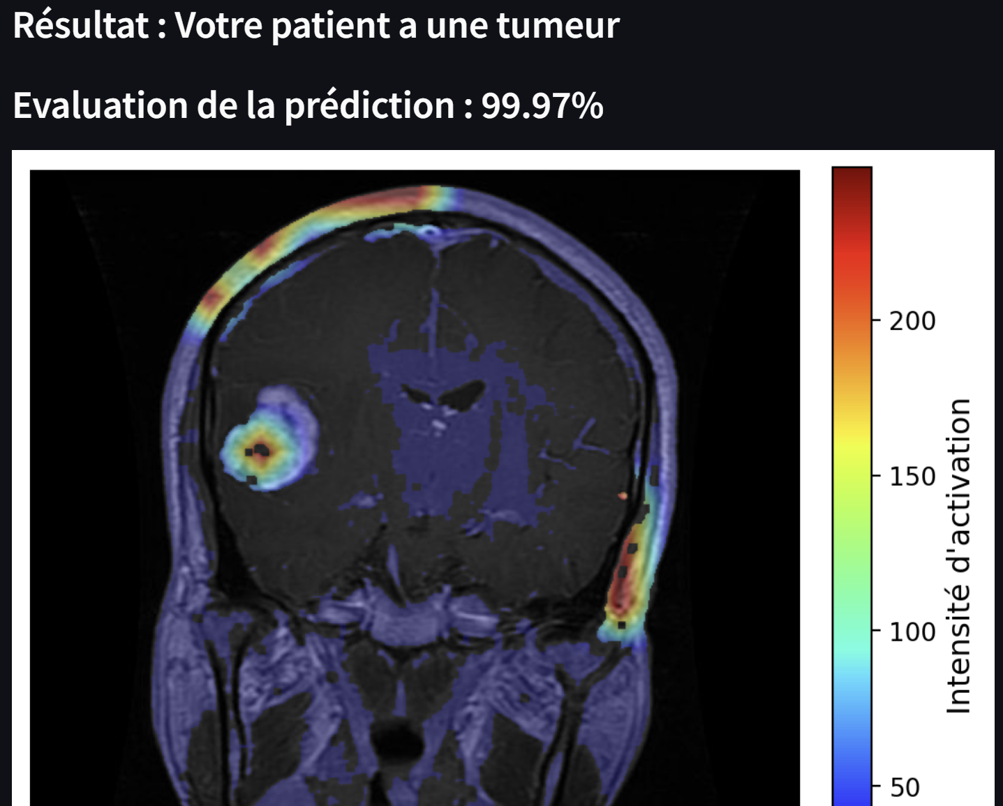 Développement en cours